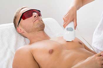 Laser Hair Removal for Men Willowbrook IL